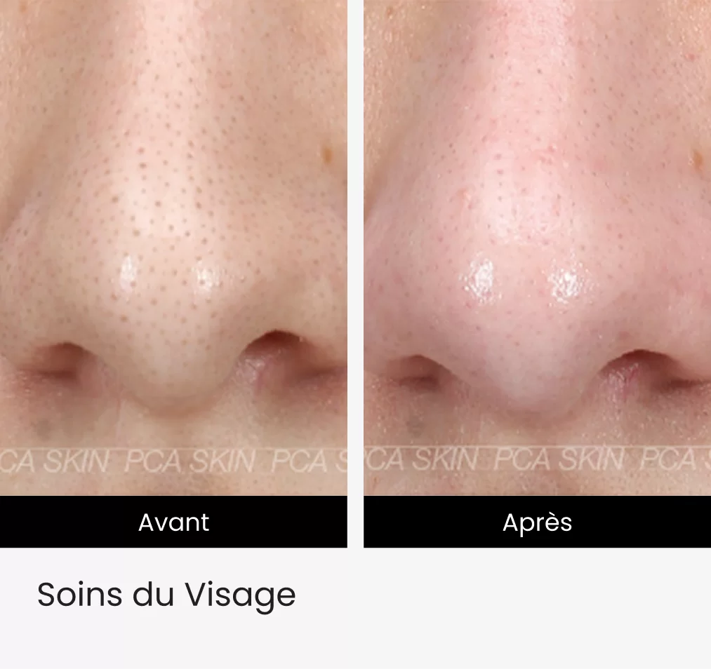 Soins-du-Visage-img.webp