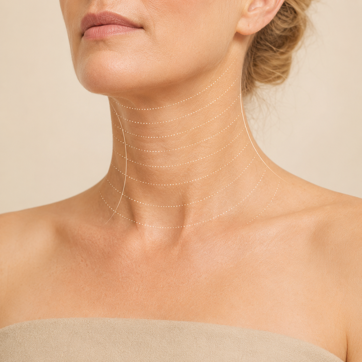 Neck Rejuvenation