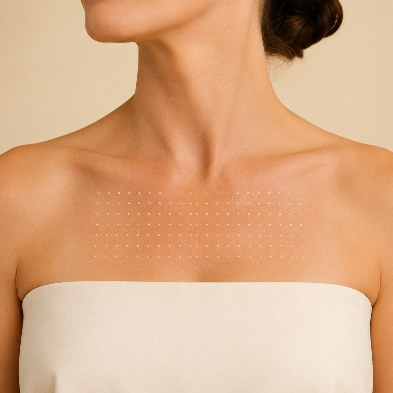 RF Microneedling — Décolleté